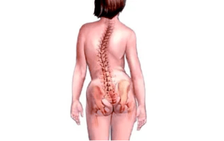 Les raisons du développement de l'ostéochondose cervicale