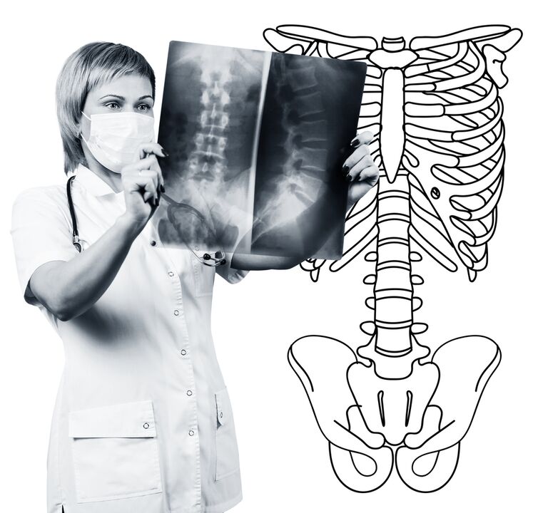 Radiographie de la colonne lombaire