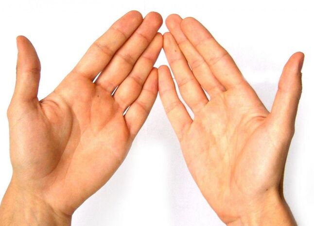 La polyarthrite rhumatoïde affecte les articulations des doigts en raison d'un dysfonctionnement du système immunitaire