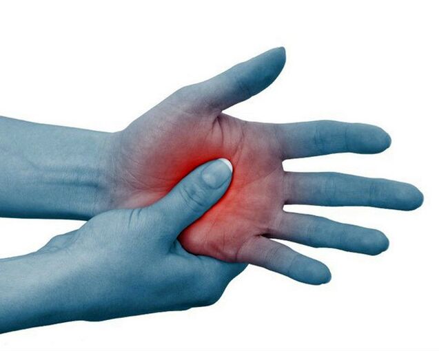 Une douleur intense dans les articulations des doigts, diminuant avec l'exercice, est un signe typique de la polyarthrite rhumatoïde. 